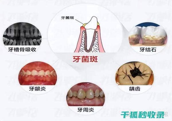 牙刷更换周期：被忽略的细节影响口腔健康 (牙刷更换周期频率图表)